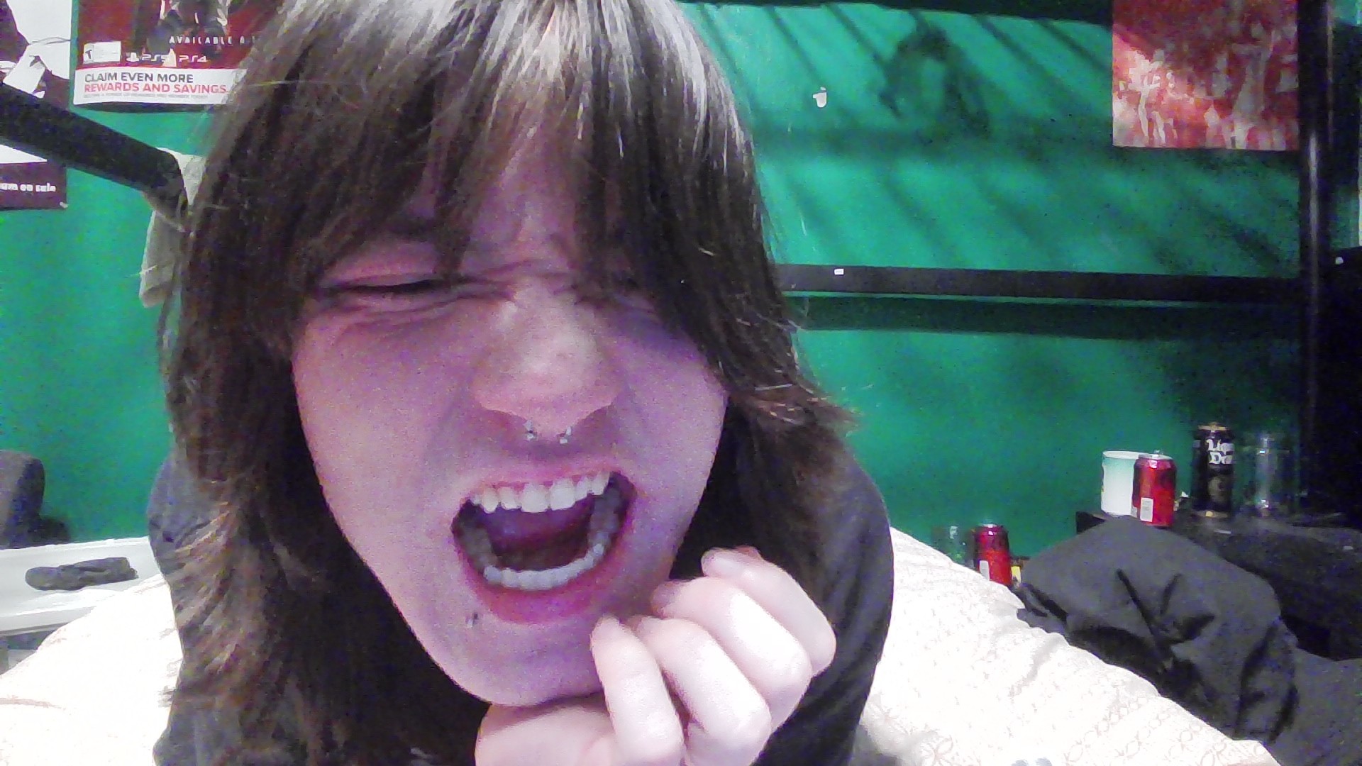 my teeth